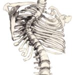 Cartoon drawing of a rib cage and spine. The spine is curved from scoliosis.