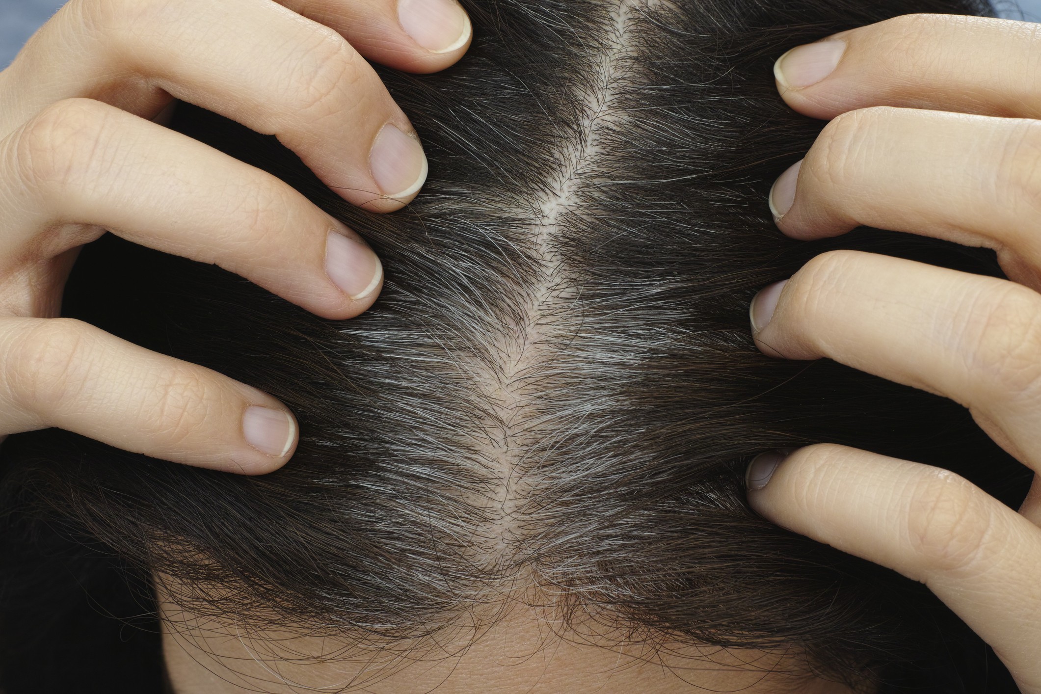 Close-up of a woman with visible grey hairs, depicting the natural process of hair turning grey with age. Understand the science behind graying hair.