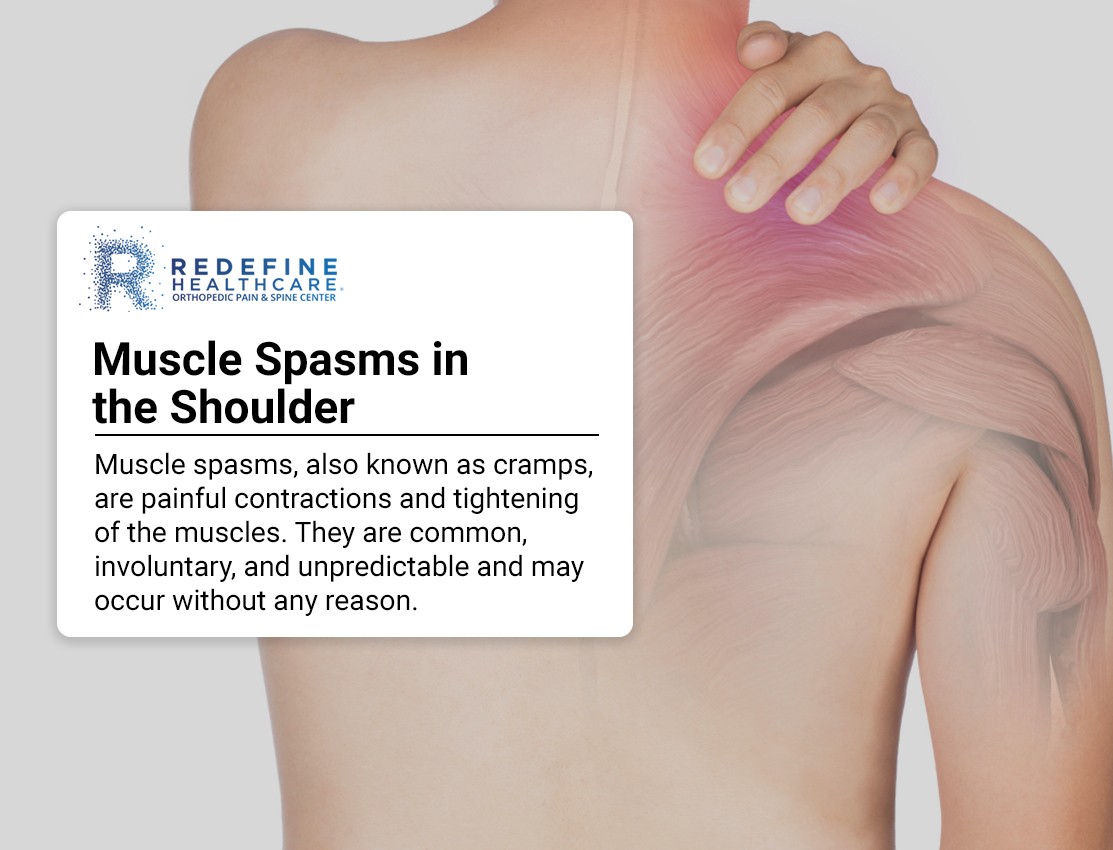 Illustration depicting shoulder muscle spasms, highlighting common pain areas. Understanding causes and treatments for shoulder twitching.