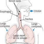 Illustration depicting the anatomy of a cough, showing lungs and the mechanics of air expulsion.