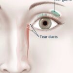 Illustration showing the location of the tear ducts and tear gland.