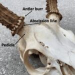 Pedicle Diagram