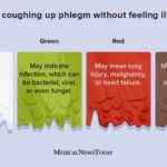 Reasons for coughing up phlegm without feeling ill, causes explained