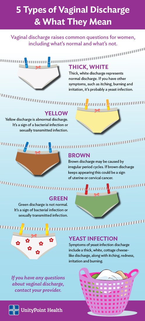 vaginal discharge infographic