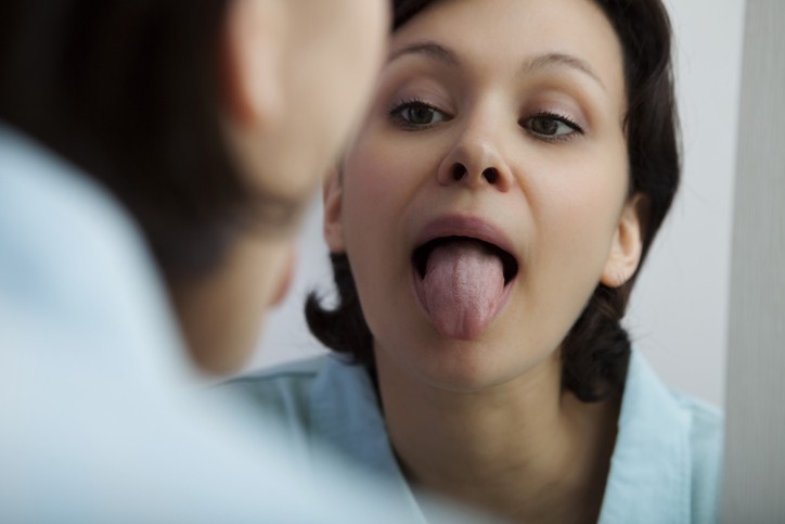 Woman examining her white tongue in mirror, checking for oral health issues and white tongue conditions