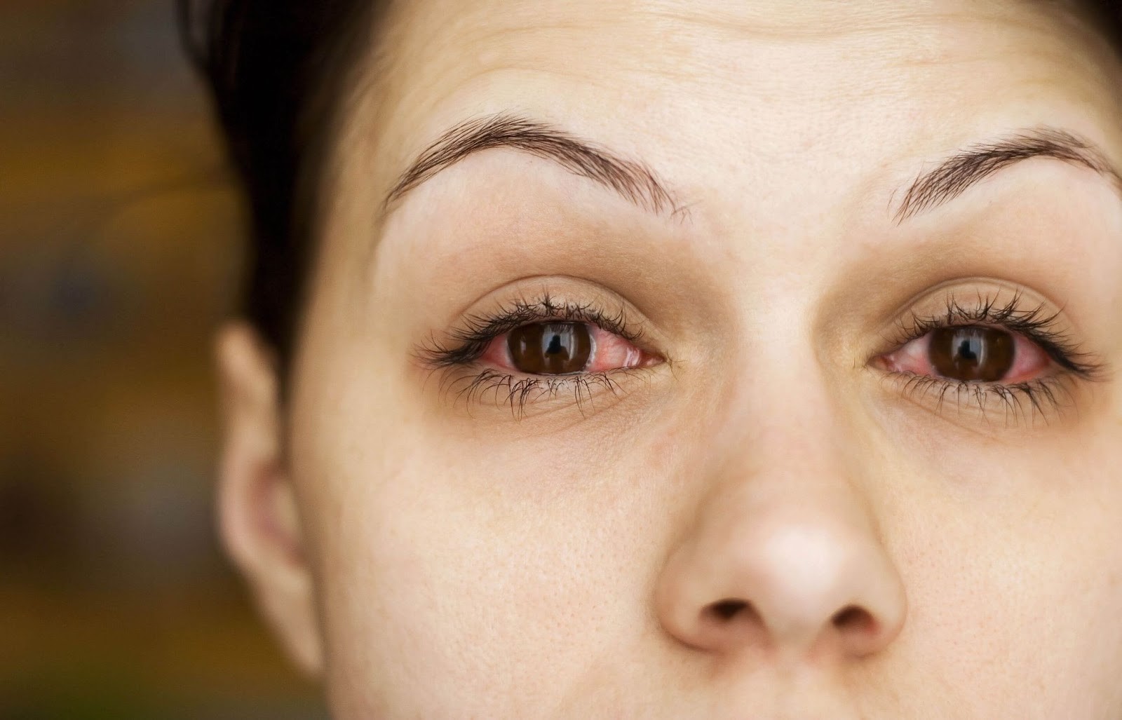 Woman experiencing dry eyes in the morning