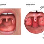 Anatomy of a cough showing the epiglottis opening and closing.