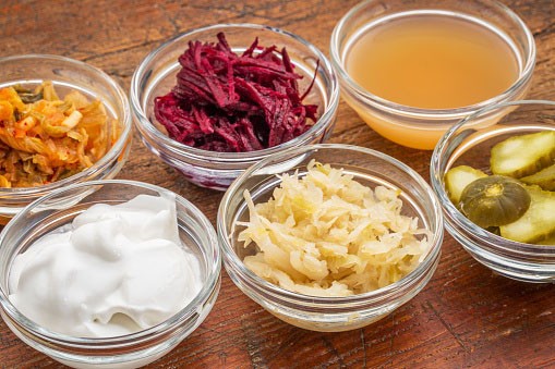 Fermented foods like kimchi, sauerkraut, and yogurt on a kitchen counter