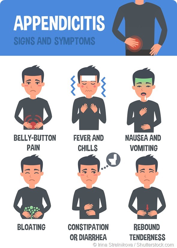 Appendicitis Symptoms